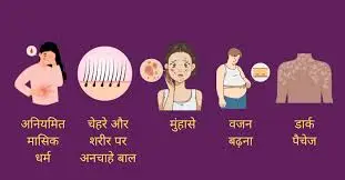 PCOD और PCOS: आसान भाषा में क्या हैं, कारण, लक्षण और इलाज