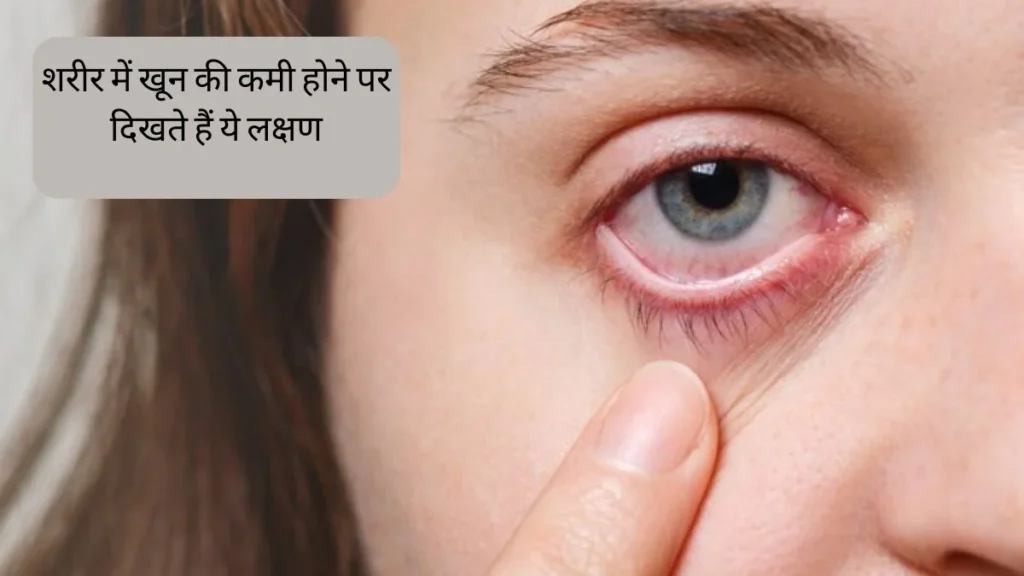 खून की कमी