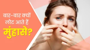 PCOS में बार-बार लौटते मुंहासे